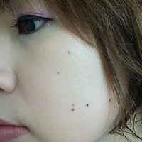アコ